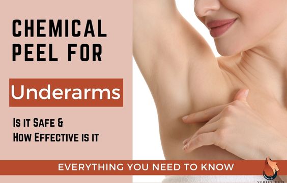 Chemical Peels for Dark Underarms – All You Need to Know