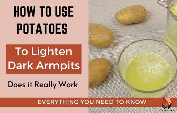 How to Use Potatoes For Underarm Whitening