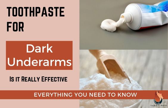 Toothpaste For Dark Underarms - Ultimate DIY Guide