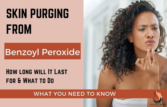 Benzoyl Peroxide Skin Purge - Everything You Need To Know 