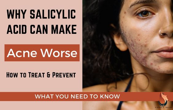 Reasons Why Salicylic Acid can make Acne Worse & What to Do