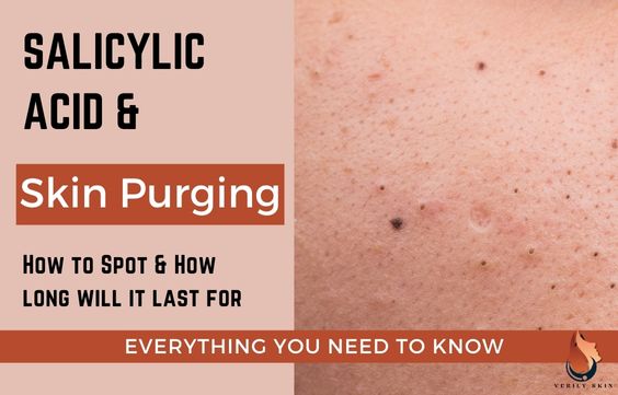 Skin Purging from Salicylic Acid: How to Spot & Treat